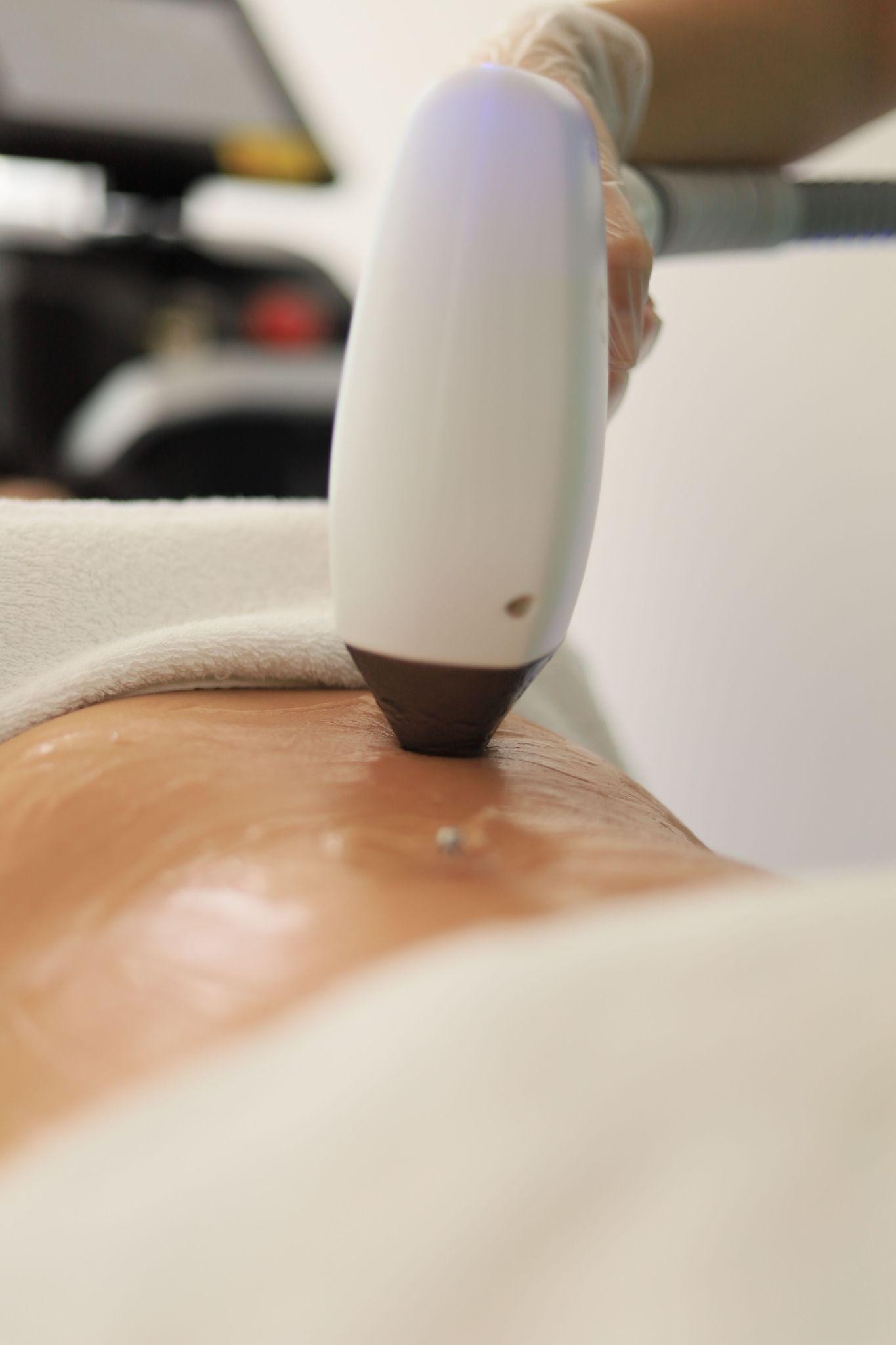 Body sculpting machine used on the abdomen