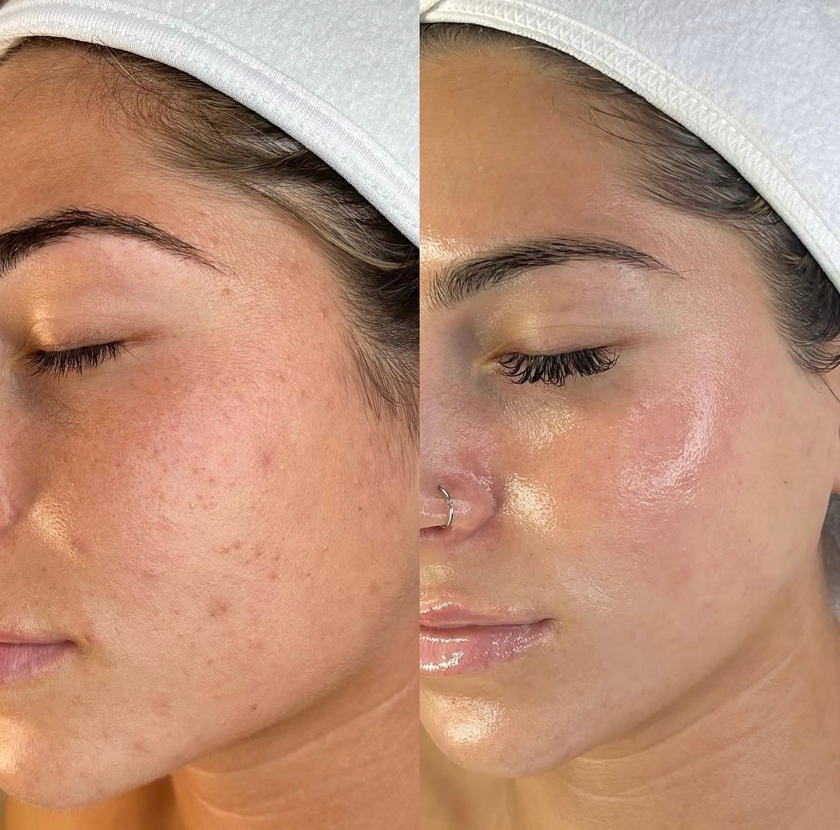 All About You Signature Facial treatment at SnatchedLV