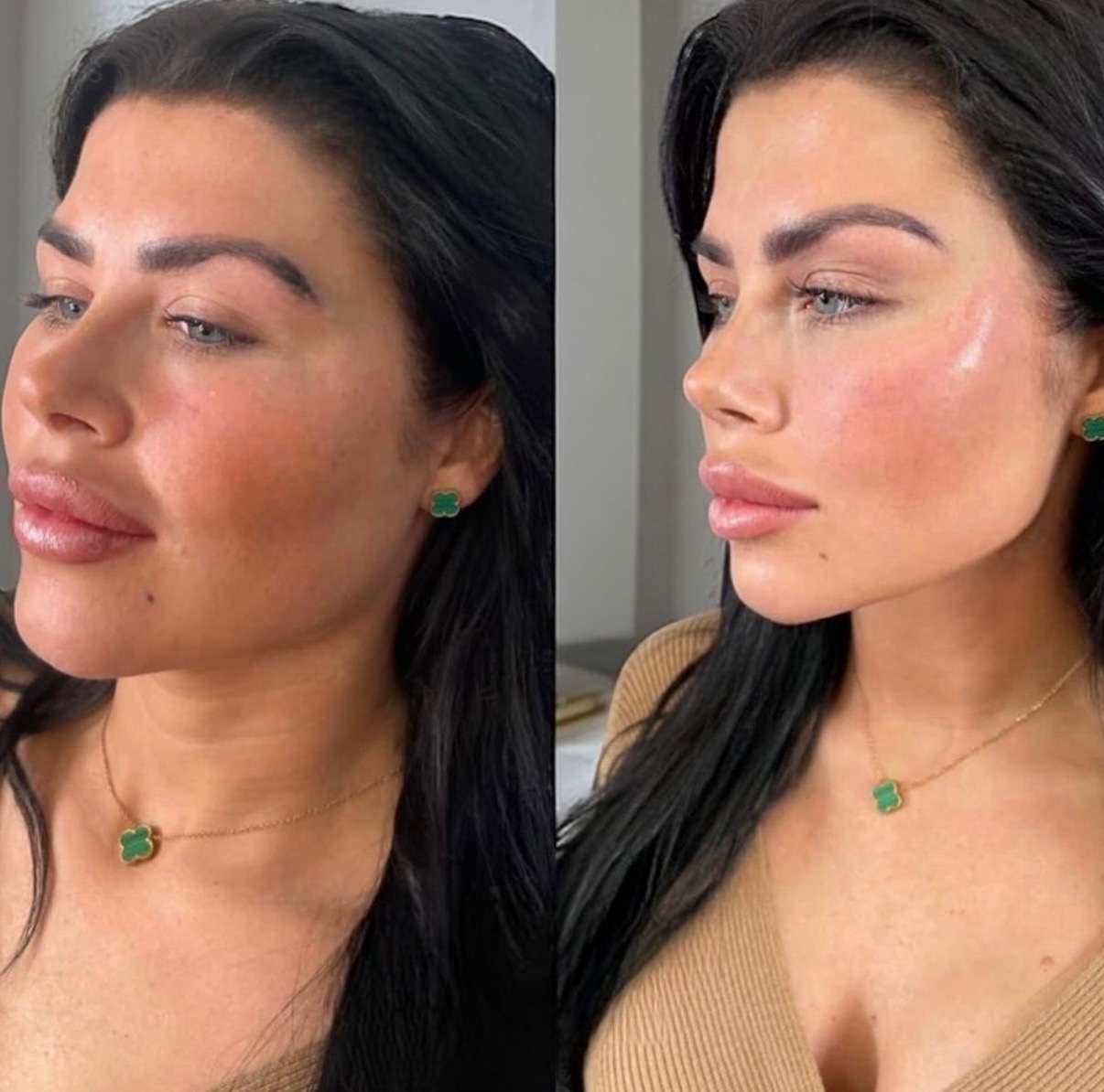 Signature Sculpt Facial treatment at SnatchedLV