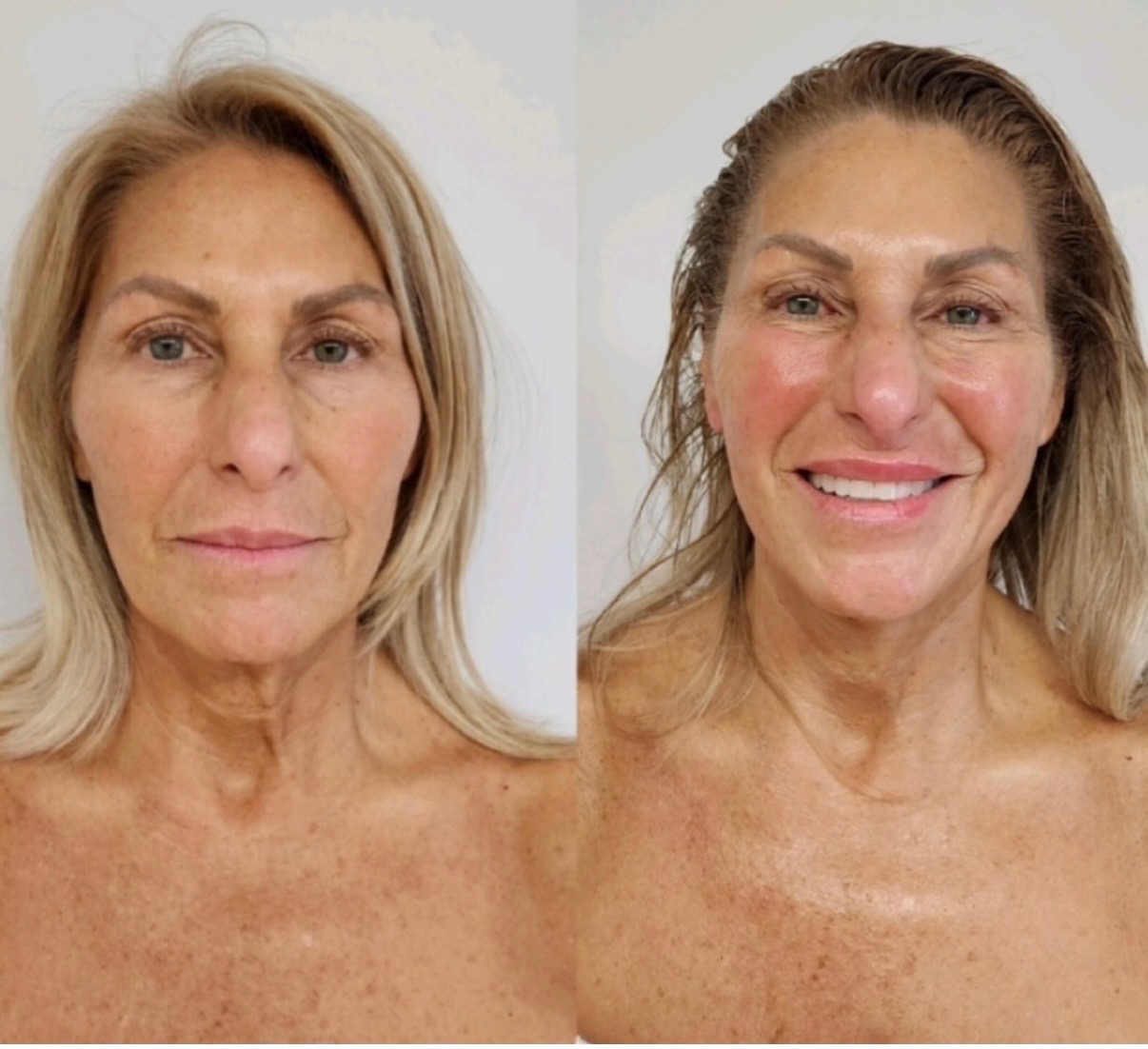 Facial Workout treatment at SnatchedLV
