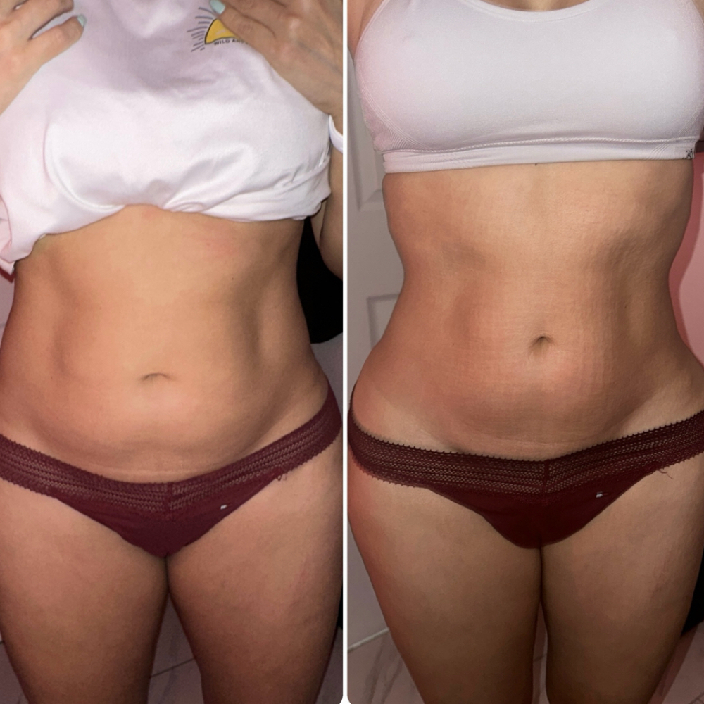 TheKylie — 3-4 Areas treatment at SnatchedLV